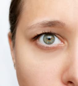 Blepharoplasty results, Antalya, Türkiye