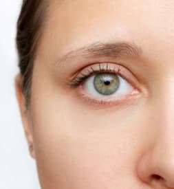Blepharoplasty results, Antalya, Türkiye